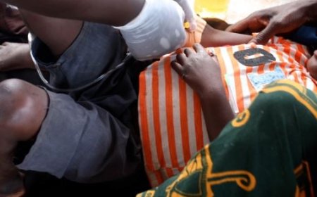 Tanganyika: Abarenga  100 bamaze kwandura icyorezo cya Cholera mu cyumweru kimwe