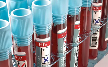 Urukingo rwa SIDA rwakorewe igerageza mu Rwanda rugaragaza icyizere gikomeye