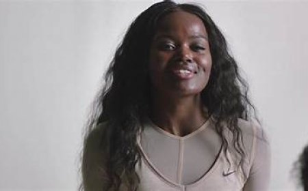 Sherrie Silver aratabariza umwana we ukorerwa ihohoterwa rishingiye ku miterere y'amenyo ye