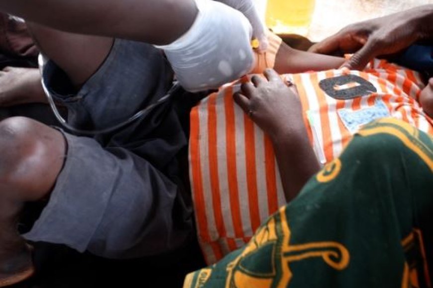 Tanganyika: Abarenga 100 bamaze kwandura icyorezo cya Cholera mu cyumweru kimwe