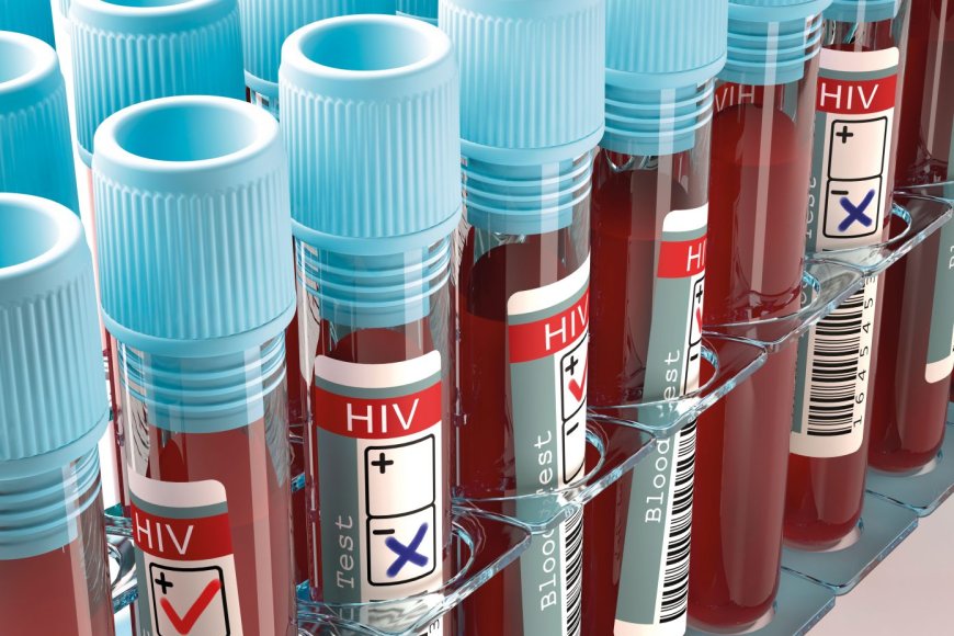 Urukingo rwa SIDA rwakorewe igerageza mu Rwanda rugaragaza icyizere gikomeye