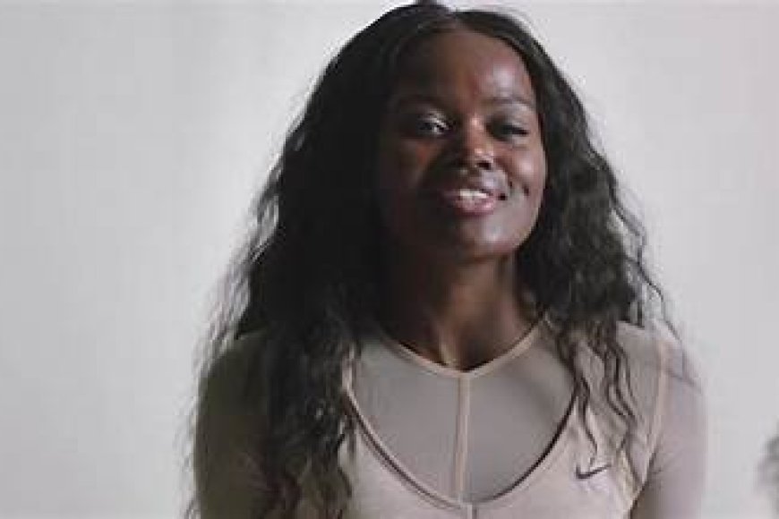 Sherrie Silver aratabariza umwana we ukorerwa ihohoterwa rishingiye ku miterere y'amenyo ye