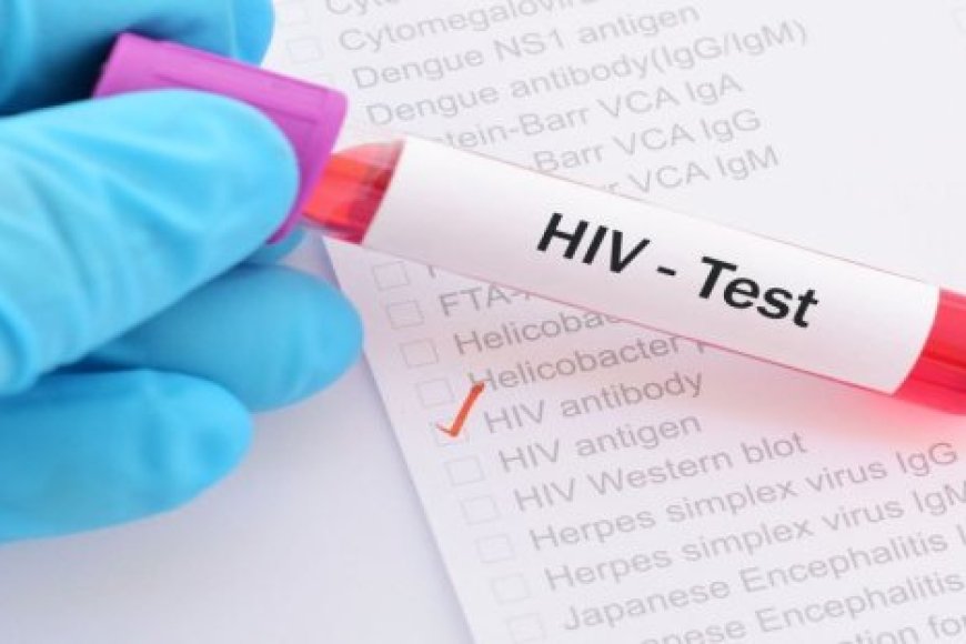 Abagera kuri 30% y’abafite Virusi itera Sida mu Rwanda bari hejuru y’imyaka 50