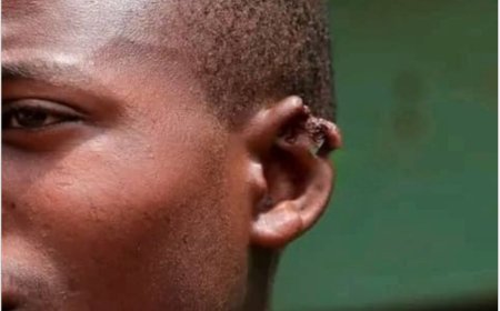 Gatsibo: Umujura yicishije ishoka umugore anaruma umugabo we ugutwi