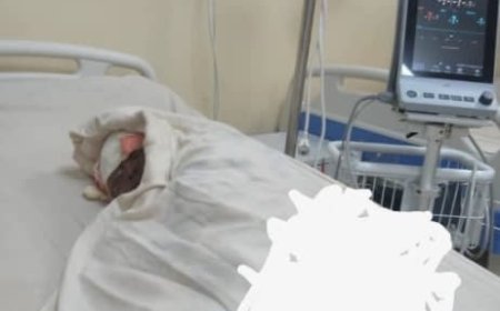 Rusizi: Umwana w’imyaka 2 yahiriye mu nzu akurwamo akiri muzima