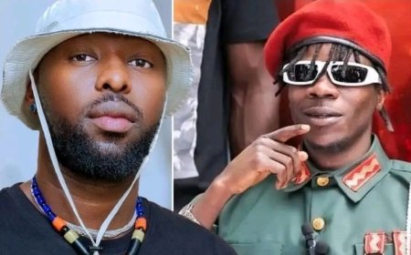 Eddy Kenzo yinjiye mu kibazo cya Alien Skin 