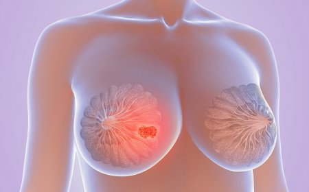 Abagororwa b’abagore bo muri gereza ya Kangbayi  batangiye kwiga uko bakwisuzuma kanseri y’ibere