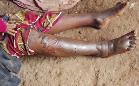 Rusizi: Afunzwe azira gutwikisha umugore we amavuta yari agiye gutekesha