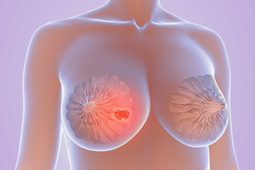 Abagororwa b’abagore bo muri gereza ya Kangbayi  batangiye kwiga uko bakwisuzuma kanseri y’ibere