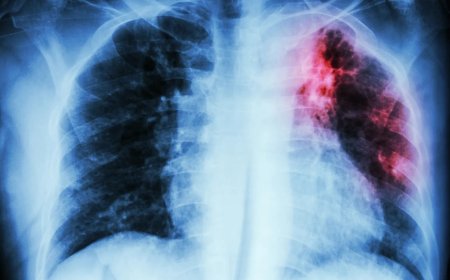 Abantu miliyoni 10 bashobora kuzandura igituntu mu myaka icumi iri imbere