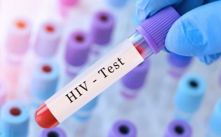 NISR: Over 54,000 Rwandans Diagnosed with HIV in the Past Six Years