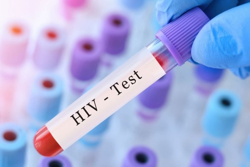 NISR: Over 54,000 Rwandans Diagnosed with HIV in the Past Six Years