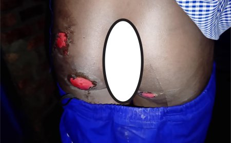 Musanze:Umugore yatwikishije umwana we ipasi ku kibuno amuziza gutaha atinze