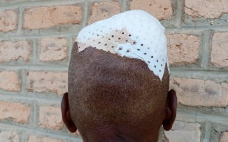 Ruhango: Gitifu arashinjwa gutema umuturage mu mutwe akoresheje umuhoro