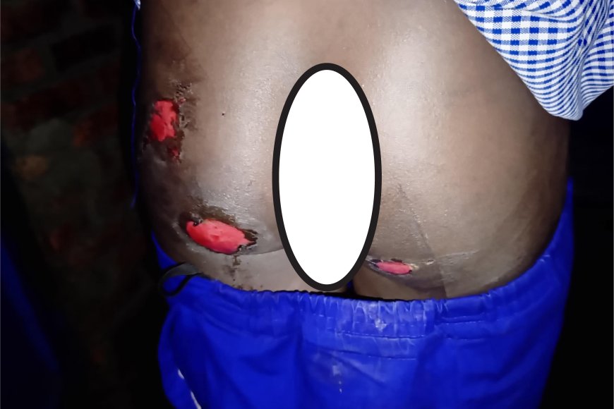 Musanze:Umugore yatwikishije umwana we ipasi ku kibuno amuziza gutaha atinze