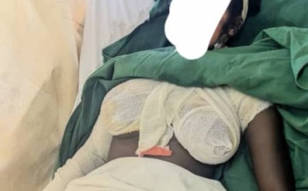 Ngororero: Umugore ukekwaho gutwikisha umukozi wo mu rugo amazi ashyushye yatawe muri yombi