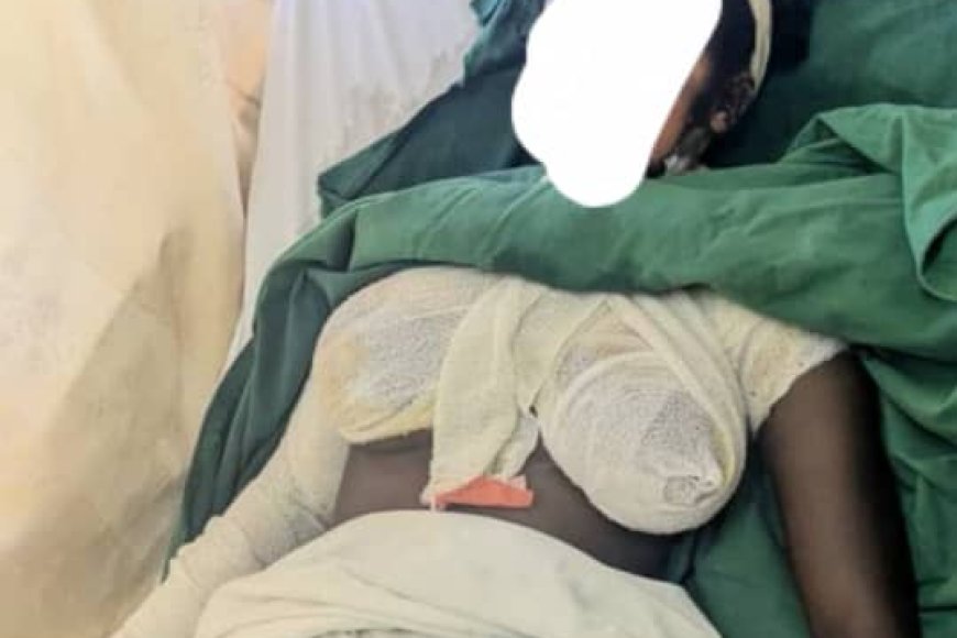 Ngororero: Umugore ukekwaho gutwikisha umukozi wo mu rugo amazi ashyushye yatawe muri yombi