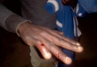 Nyakabanda: Isindwe ryatumye umukozi w’akabari arwana n’umukiriya karahava
