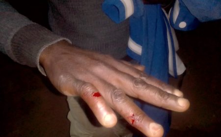 Nyakabanda: Isindwe ryatumye umukozi w’akabari arwana n’umukiriya karahava