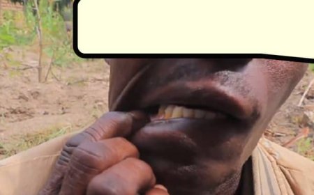 Ruhango: Umugore yakuye iryinyo umugabo we, nyuma yo kumusangana indaya mu buriri
